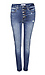 Exposed Button Fly Ankle Denim Thumb 1